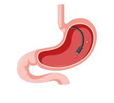 ECRP TReatment Services | Expert Digestive Care